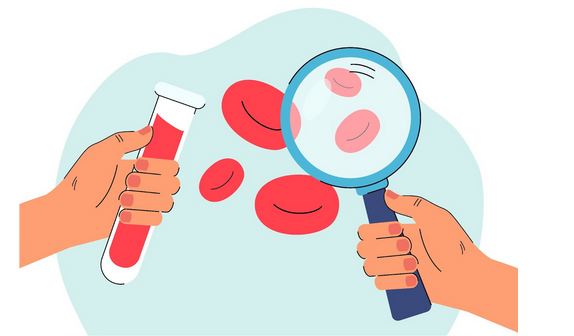 تشخيص فقر الدم في العيادة